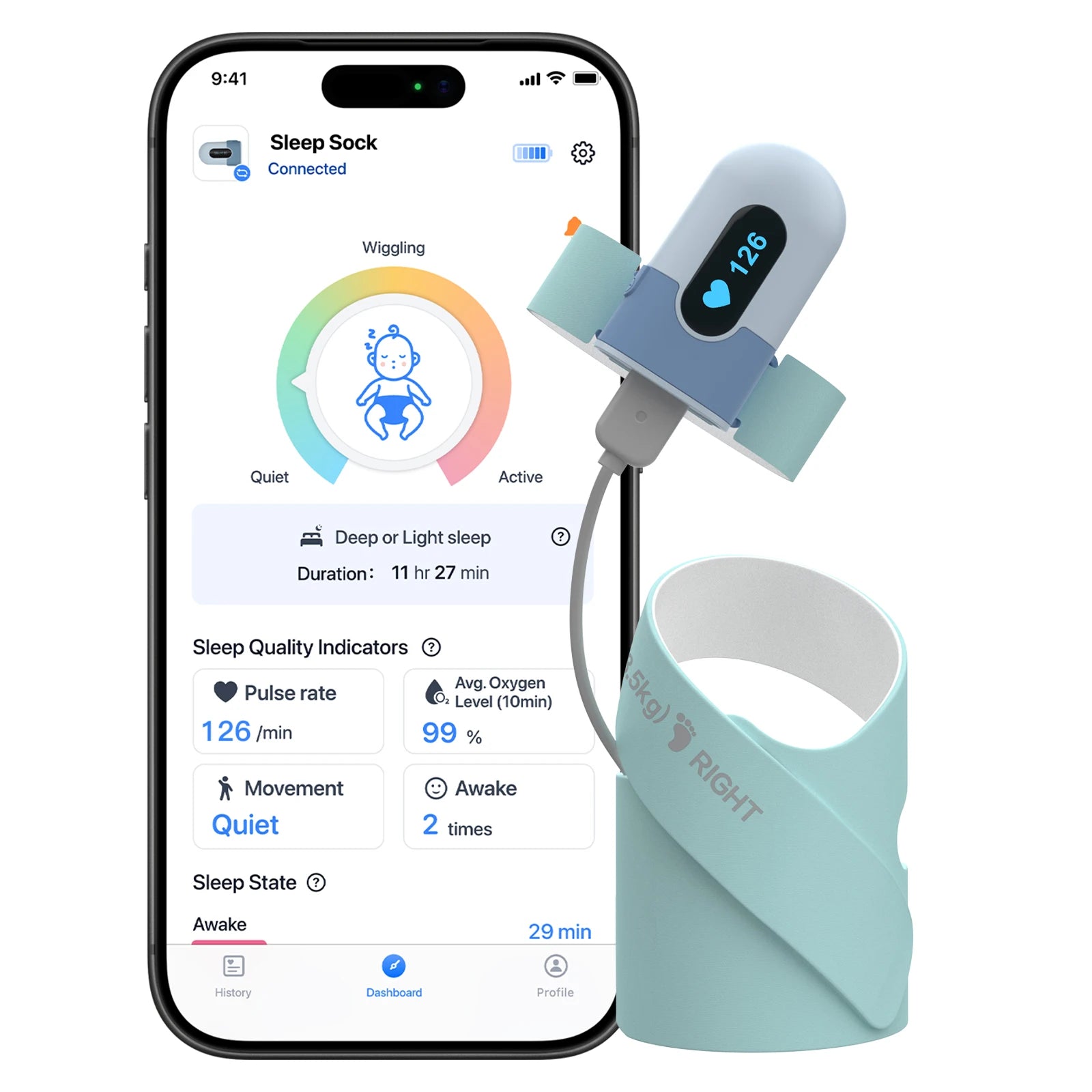 Viatom BabyO2 Bluetooth Digital Oximeters Child Apnea Sleep Device Neonate Pulse Oximeter